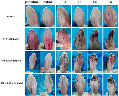 The inhibiting effect of alpha-based TARE on embolized vessels and neovascularization